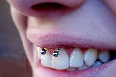 how long does the smiley piercing take to heal|The Smiley Piercing: Pain Level, Aftercare, and Jewelry